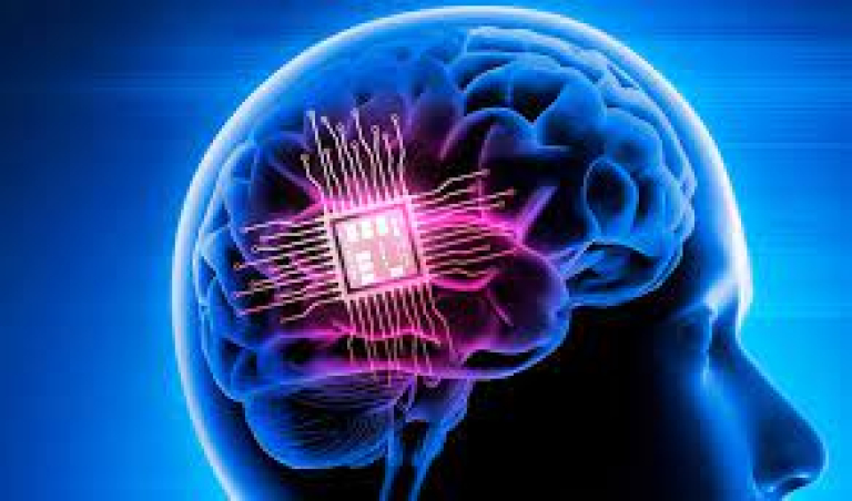Neuralink faz 1º implante de chip cerebral em humano; veja detalhes